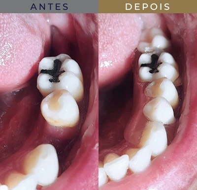 dentista no Flamengo resultado 5